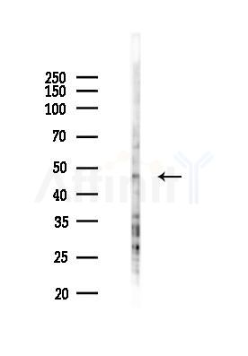 GALR2 Antibody - Western blot analysis of lysates from 293 cells(UV 30min treatment), using GALR2 Antibody at 1/1000 dilution.
