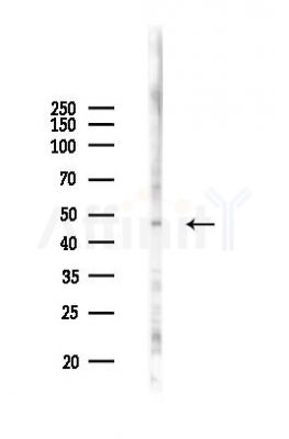 GHRHR Antibody - Western blot analysis of lysates from COLO205 cells(UV 30min treatment), using GHRHR Antibody at 1/1000 dilution.