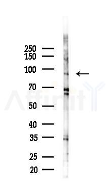 GPR133 Antibody - Western blot analysis of lysates from COLO205 cells(starvation 24h treatment), using GPR133 Antibody at 1/1000 dilution.
