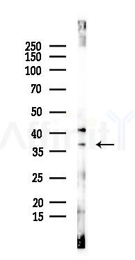 GPR157 Antibody - Western blot analysis of lysates from B16F10-LUC cells(heat-shock 45min treatment), using GPR157 Antibody at 1/1000 dilution.