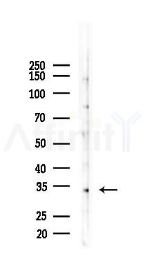 GPR35 Antibody - Western blot analysis of lysates from COLO205 cells(starvation 24h treatment), using GPR35 Antibody at 1/1000 dilution.