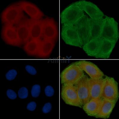 GPR83/GPR72 Antibody - DF4977 staining Hela cells(30min of UV treatment) by IF/ICC.