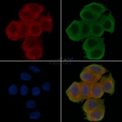 NPY2R Antibody - DF5000 staining Hela cells(30min of UV treatment) by IF/ICC.