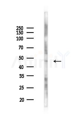 OPRK1 Antibody - Western blot analysis of lysates from 293 cells(UV 30min treatment), using OPRK1 Antibody at 1/1000 dilution.