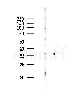 OR2I1 Antibody - Western blot analysis of lysates from PC12 cells(UV 30min treatment), using OR2I1 Antibody at 1/1000 dilution.