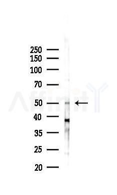 VIPR2 Antibody - Western blot analysis of lysates from 293 cells(LPS 4h treatment), using VIPR2 Antibody at 1/1000 dilution.