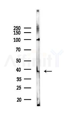 PAR4 Antibody - Western blot analysis of lysates from Hela cells(heat-shock 45min treatment), using PAR4 Antibody at 1/1000 dilution.