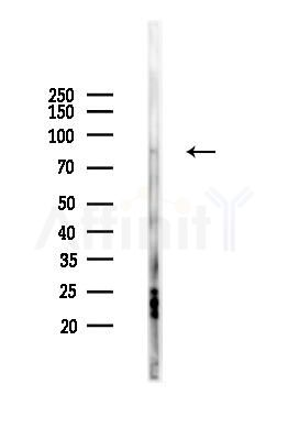 PI3K p85 alpha Antibody - Western blot analysis of lysates from Mouse liver, using PI3K p85 alpha Antibody at 1/1000 dilution.