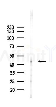 SPHK1 Antibody - Western blot analysis of lysates from HUVEC cells(LPS 4h treatment), using SPHK1 Antibody at 1/1000 dilution.