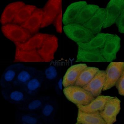 AFP Antibody - DF6007 staining Hela cells(30min of UV treatment) by IF/ICC.