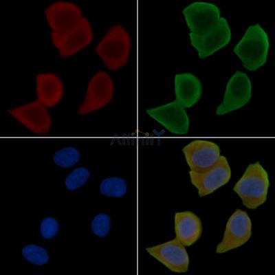 GFAP Antibody - DF6040 staining Hela cells(30min of UV treatment) by IF/ICC.
