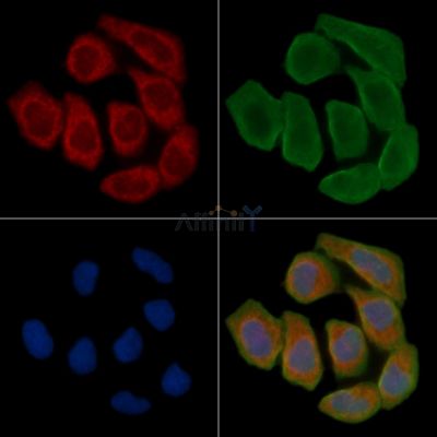 Interferon gamma Antibody - DF6045 staining Hela cells(30min of UV treatment) by IF/ICC.