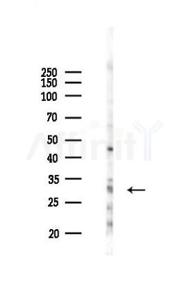PSME3 Antibody - Western blot analysis of lysates from COLO205 cells(UV 30min treatment), using PSME3 Antibody at 1/1000 dilution.