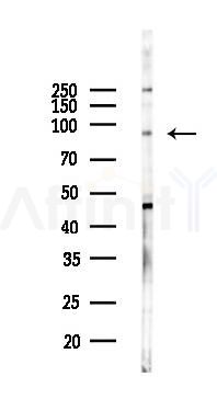 VCAM1 Antibody - Western blot analysis of lysates from K562 cells(UV 30min treatment), using VCAM1 Antibody at 1/1000 dilution.