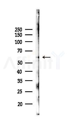 AKT2 Antibody - Western blot analysis of lysates from PC12 cells(LPS 4h treatment), using AKT2 Antibody at 1/1000 dilution.