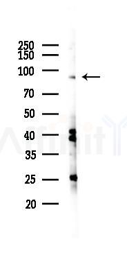 Hsp90 alpha Antibody - Western blot analysis of lysates from K562 cells(UV 30min treatment), using Hsp90 alpha Antibody at 1/1000 dilution.