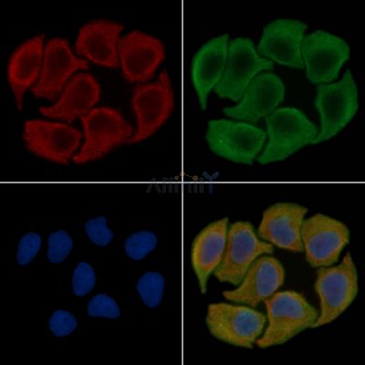 Grp75 Antibody - DF6108 staining Hela cells(30min of UV treatment) by IF/ICC.