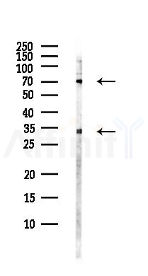 NRG1 Antibody - Western blot analysis of lysates from PC12 cells(LPS, 4h treatment), using NRG1 Antibody at 1/1000 dilution.