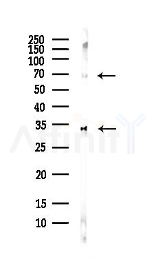 NRG1 Antibody - Western blot analysis of lysates from COLO205 cells(heat-shock,45min treatment), using NRG1 Antibody at 1/1000 dilution.