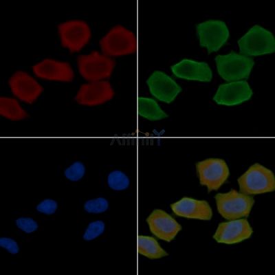MMP7 Antibody - DF6134 staining Hela cells(30min of UV treatment) by IF/ICC.