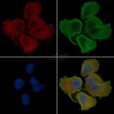 ARF6 Antibody - DF6170 staining Hela cells(30min of UV treatment) by IF/ICC.