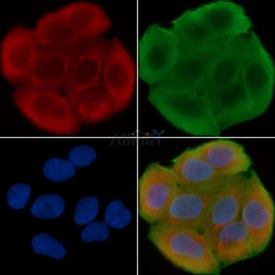 GRP94 Antibody - DF6171 staining Hela cells(30min of UV treatment) by IF/ICC.