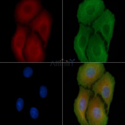 PPIA Antibody - DF6175 staining Hela cells(30min of UV treatment) by IF/ICC.