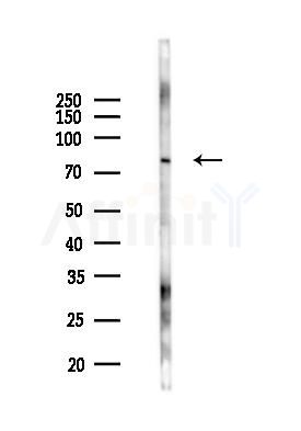 SERPINA3 Antibody - Western blot analysis of lysates from 293 cells(UV 30min treatment), using SERPINA3 Antibody at 1/1000 dilution.
