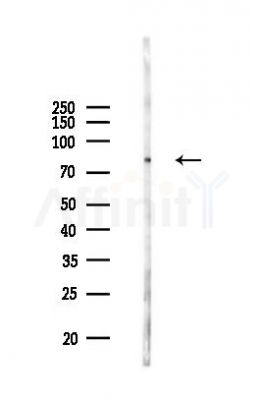 SERPINA3 Antibody - Western blot analysis of lysates from COLO205 cells(UV 30min treatment), using SERPINA3 Antibody at 1/1000 dilution.