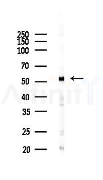 SGK1 Antibody - Western blot analysis of lysates from K562 cells(UV 30min treatment), using SGK1 Antibody at 1/1000 dilution.