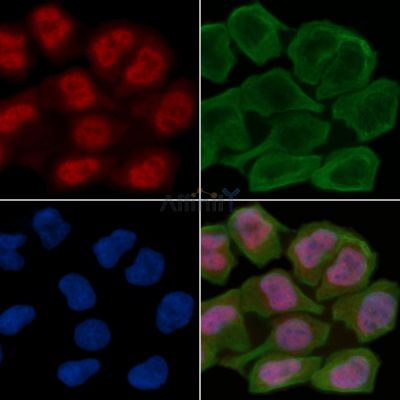 MCM2 Antibody - DF6201 staining Hela cells(30min of UV treatment) by IF/ICC.