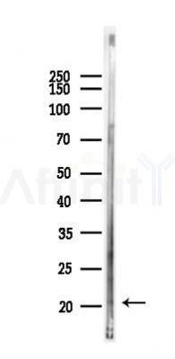 TDGF1 Antibody - Western blot analysis of lysates from Rat brain, using TDGF1 Antibody at 1/1000 dilution.