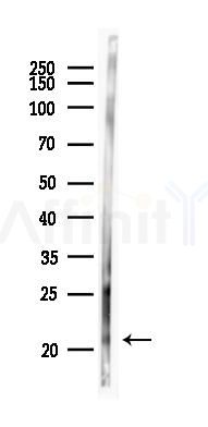 TDGF1 Antibody - Western blot analysis of lysates from EC304 cells(starvation 24h treatment), using TDGF1 Antibody at 1/1000 dilution.