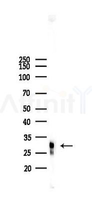 RNASE11 Antibody - Western blot analysis of lysates from Hela cells(starvation 24h treatment), using RNASE11 Antibody at 1/1000 dilution.
