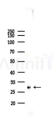 RNASE11 Antibody - Western blot analysis of lysates from A2780 cells(starvation 24h treatment), using RNASE11 Antibody at 1/1000 dilution.