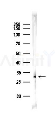 RNASE11 Antibody - Western blot analysis of lysates from EC304 cells(starvation 24h treatment), using RNASE11 Antibody at 1/1000 dilution.