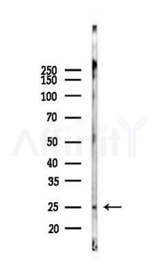 HP1 alpha Antibody - Western blot analysis of lysates from Mouse lung, using HP1 alpha Antibody at 1/1000 dilution.