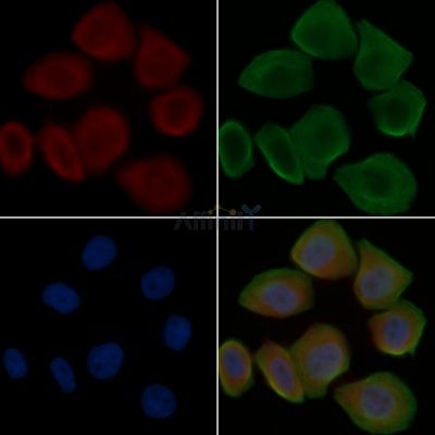 TNNT2 Antibody - DF6261 staining Hela cells(30min of UV treatment) by IF/ICC.