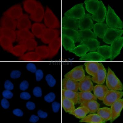 APOA1 Antibody - DF6264 staining Hela cells(30min of UV treatment) by IF/ICC.