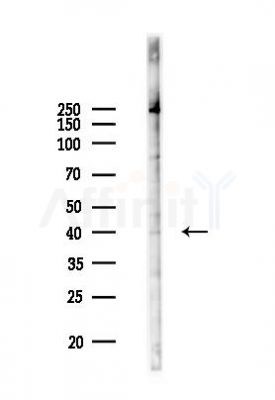 Doublecortin Antibody - Western blot analysis of lysates from COLO205 cells(UV 30min treatment), using Doublecortin Antibody at 1/1000 dilution.