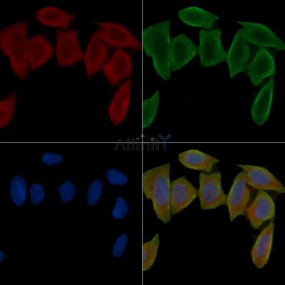 FTH1 Antibody - DF6278 staining Hela cells(30min of UV treatment) by IF/ICC.