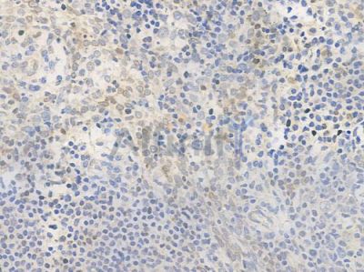 PHD2 Antibody - DF6285 at 1/100 staining human normal tonsil tissue by IHC-P.
