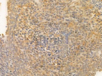 KDM1A Antibody - DF6290 at 1/100 staining human normal tonsil tissue by IHC-P.