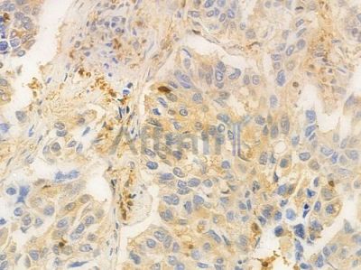 Profilin 1 Antibody - DF6298 at 1/100 staining human normal kidney tissue by IHC-P.