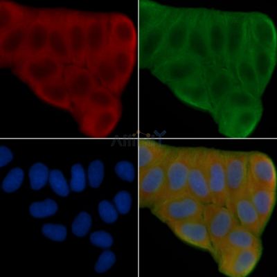 Profilin 1 Antibody - DF6298 staining Hela cells(30min of UV treatment) by IF/ICC.