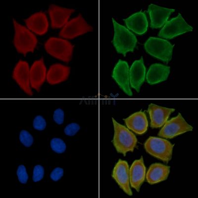 CAPN1 Antibody - DF6306 staining Hela cells(30min of UV treatment) by IF/ICC.