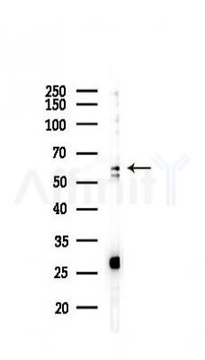 Tyrosinase Antibody - Western blot analysis of lysates from PC12 cells(LPS 4h treatment), using Tyrosinase Antibody at 1/1000 dilution.