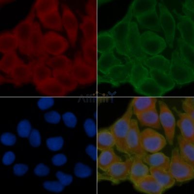 PTPN22 Antibody - DF6407 staining Hela cells(24h of starvation treatment) by IF/ICC.