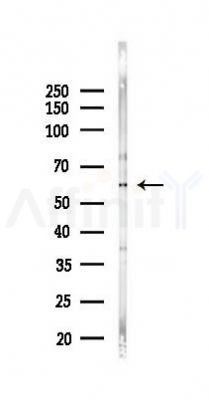 TGFBR2 Antibody - Western blot analysis of lysates from 293 cells(LPS 4h treatment), using TGFBR2 Antibody at 1/1000 dilution.
