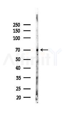 TLR3 Antibody - Western blot analysis of lysates from 293 cells(LPS 4h treatment), using TLR3 Antibody at 1/1000 dilution.